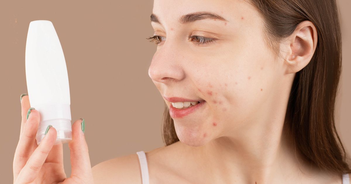 Acne in Adults: Why It Happens and What Really Works